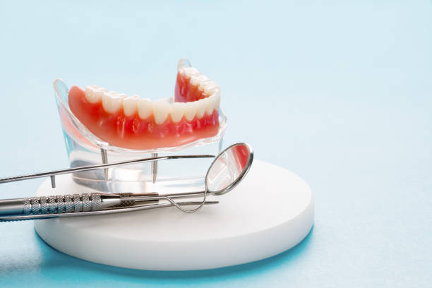 Best Veneers and Lumineers  in Marionville, MO